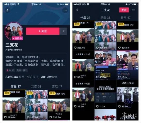 抖音如何展示才艺：引爆你的短视频魅力